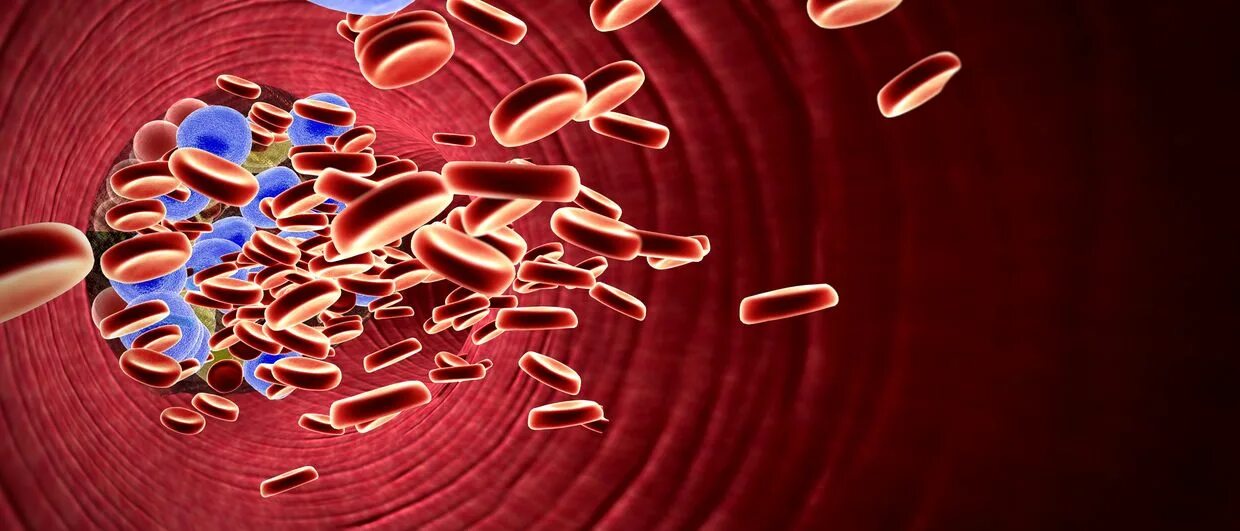 Холестерин после стентирования. Холестерин в крови. triglecidi v krovi. cholesterol blood. high blood cholesterol.