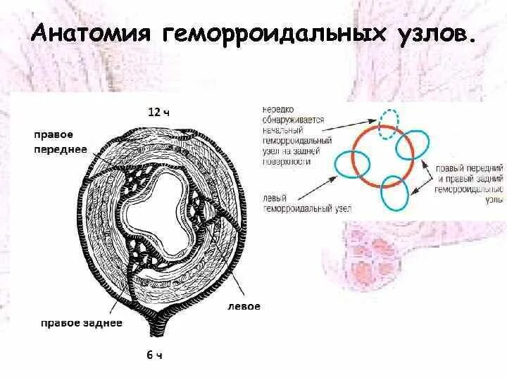 Расположение геморроидальных узлов по часам схема