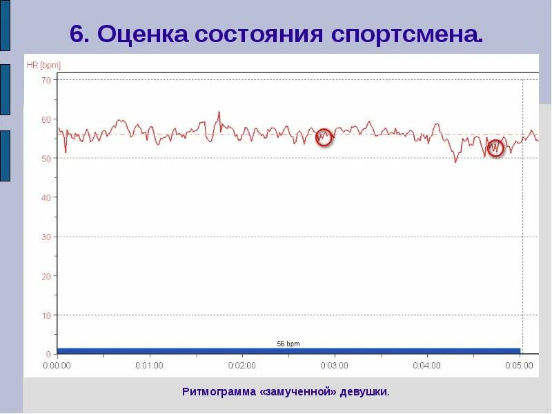 Ритмограмма. Ритмограмма в норме. Ритмограмма сердца. Анализ интервалов r-r. Оценка состояния спортсмена