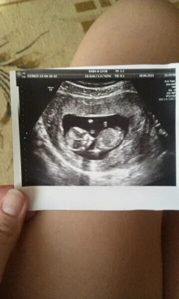 The last time people were excited to see me. - 9GAG