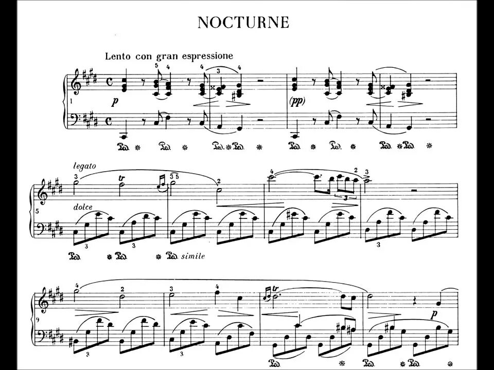 Ноктюрн шопена слушать фортепиано. Chopin Nocturne in c Sharp Minor no. 20. Шопен Ноктюрн 20. Nocturne in c-Sharp Minor, op Posth. Фредерик Шопен Nocturne no. 20 in.