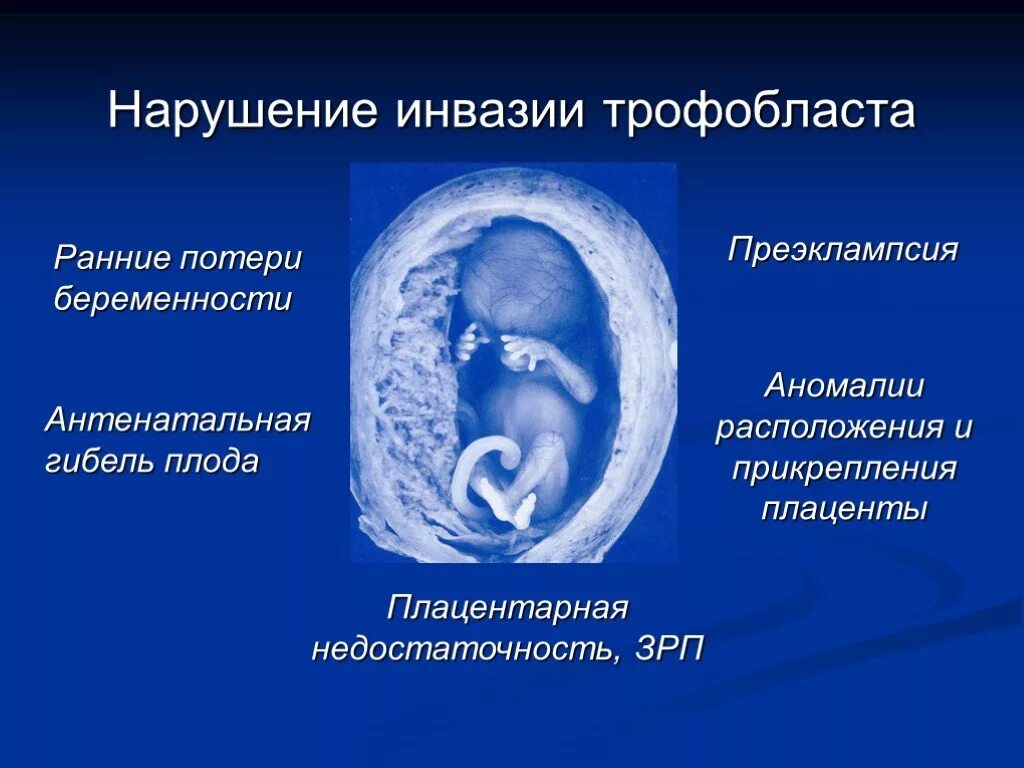 Беременность замершая симптомы признаки на раннем сроке. Инвазия трофобласта. Патологии развития плода. Аномалии развития эмбриона.