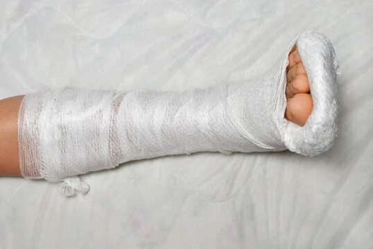 Аллергия на гипс при переломе как выглядит 