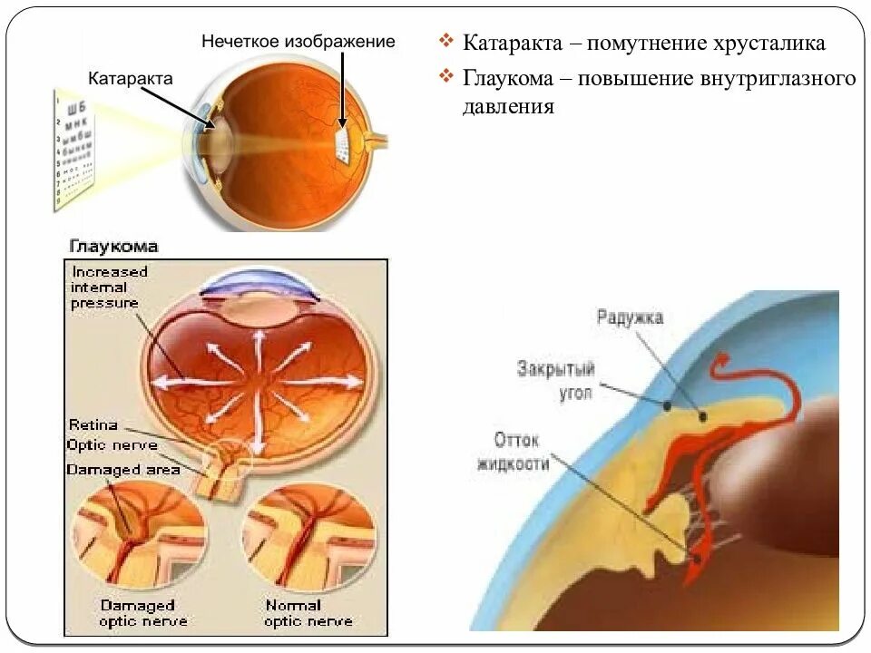 Внутриглазное давление. Циркуляция внутриглазной жидкости анатомия.