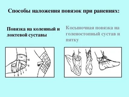 Гипертоническая повязка