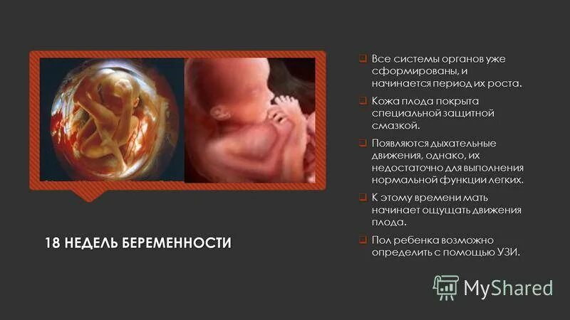 17-18 Недель беременности. Ребёнок на 18 неделе беременности.