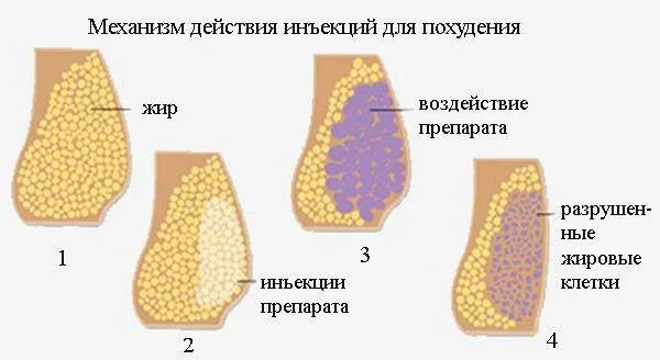 Виды липолитиков. Липолитики названия препаратов. Fnc30 липолитик. Липолитики препараты. Липолитики в живот схема.