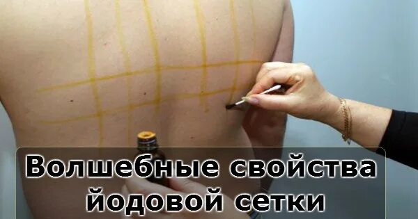 Йодную сетку можно делать ребенку