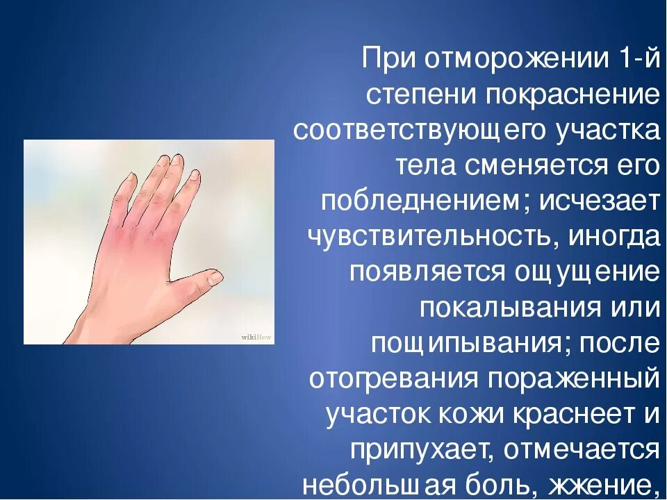 Картинки ПРИЗНАКИ ОБМОРОЖЕНИЯ ПАЛЬЦА
