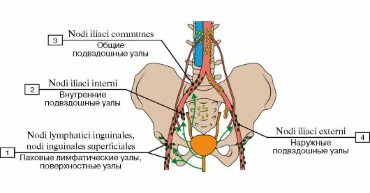 Лимфатический узел какой врач. Лимфатические узлы малого таза схема. Наружные подвздошные лимфатические узлы. Подвздошные лимфоузлы строение. Подвздошные лимфоузлы схема.