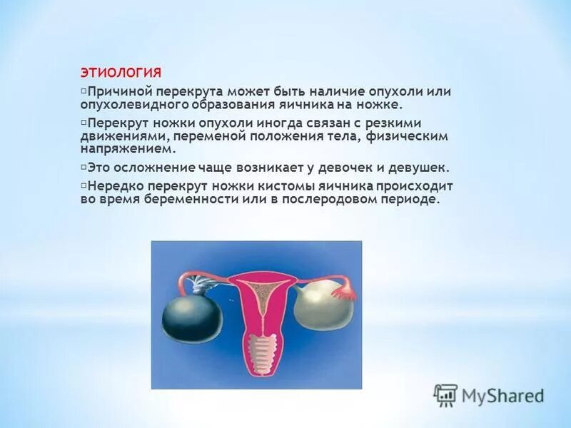 перекрут какая боль. перекрут какая боль. перекручивание семенного канатика. ноющие боли в левой половине мошонки. киста семенного канатика на узи протокол.