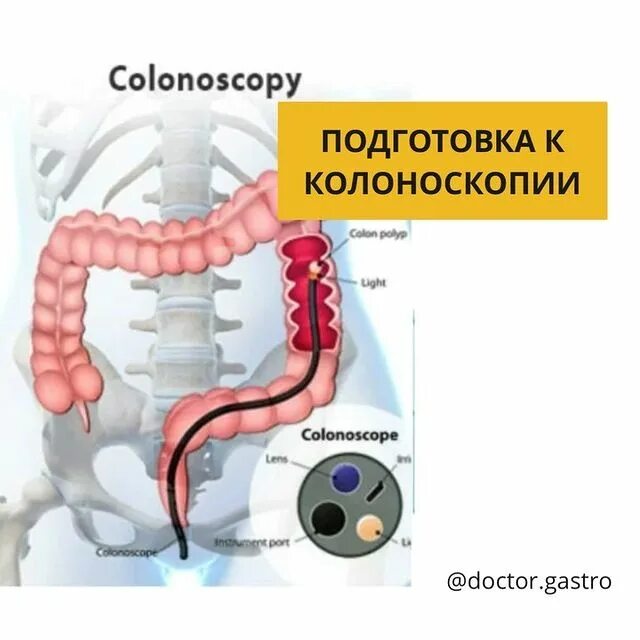 Обследование толстого кишечника. Гастро колоноскопия подготовка. колоноскопия какие отделы кишечника.