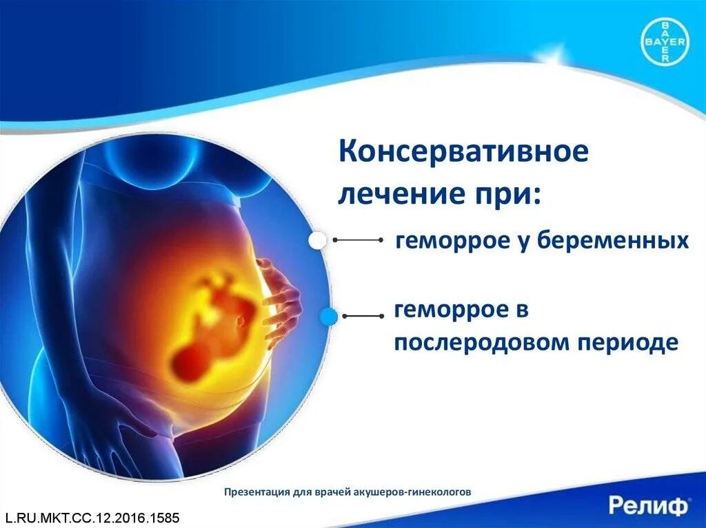Геморрой при беременности 3 триместр. Как лечить геморрой при беременности на 2 триместре беременности. Геморроидальные узлы у беременных. Геморрой наружный узел при беременности.