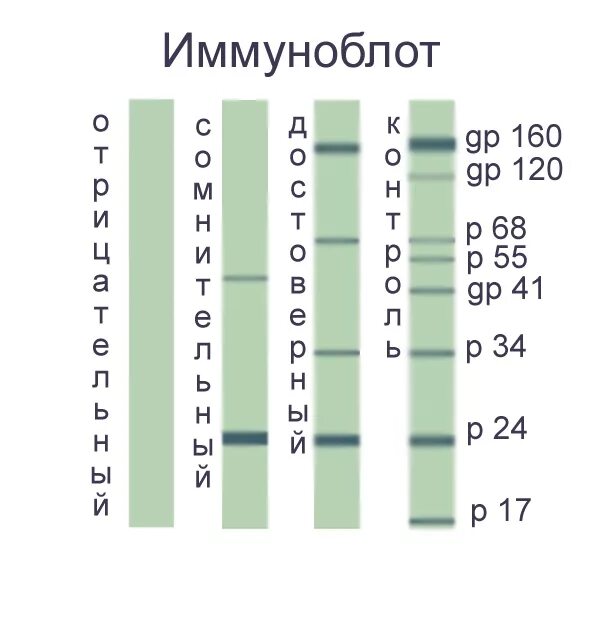 Иммуноблот ВИЧ результат. Иммуноблоттинг ВИЧ инфекции. Иммуноблот ВИЧ интерпретация результатов. Иммуноблоттинг ВИЧ анализы.