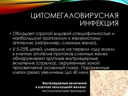 Цитомегаловирусная инфекция препараты