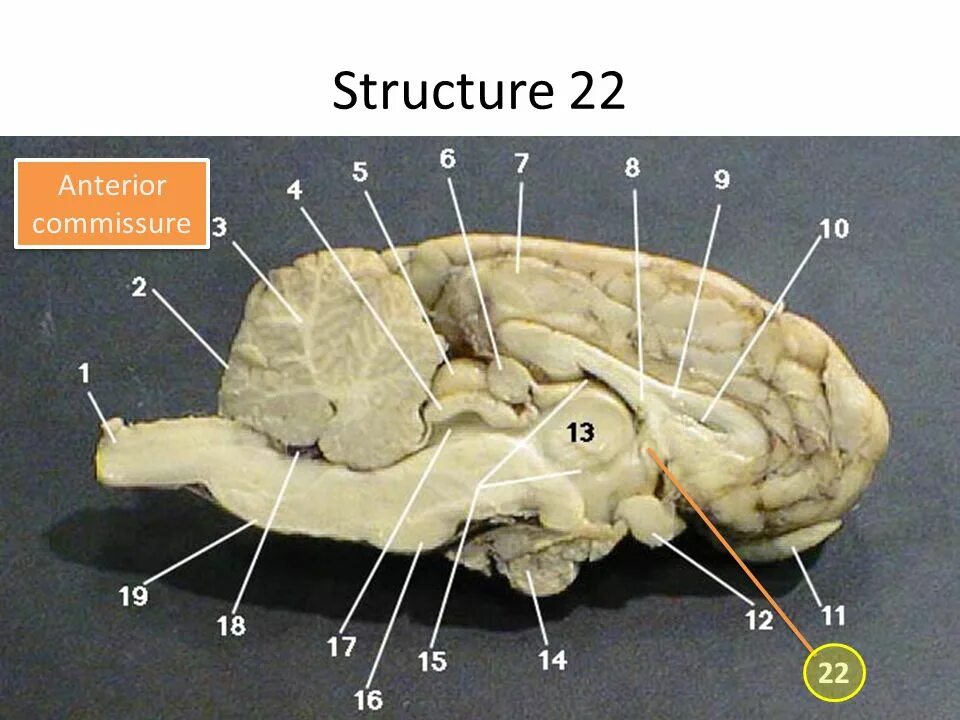 Colliculus superior