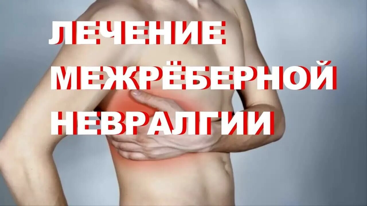 Невралгия при вдохе. Межреберная невралгия лечение. терапия межреберной невралгии. лечить межреберную невралгию в домашних условиях. межреберная невралгия народные средства.