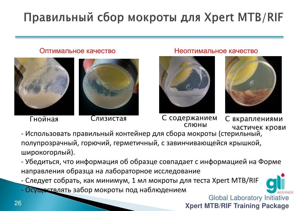 Типы мокроты по цвету. Цвета мокроты при различных заболеваниях. Цвет слизисто-гнойной мокроты. Что пить слизь