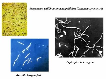 Treponema pallidum что это такое