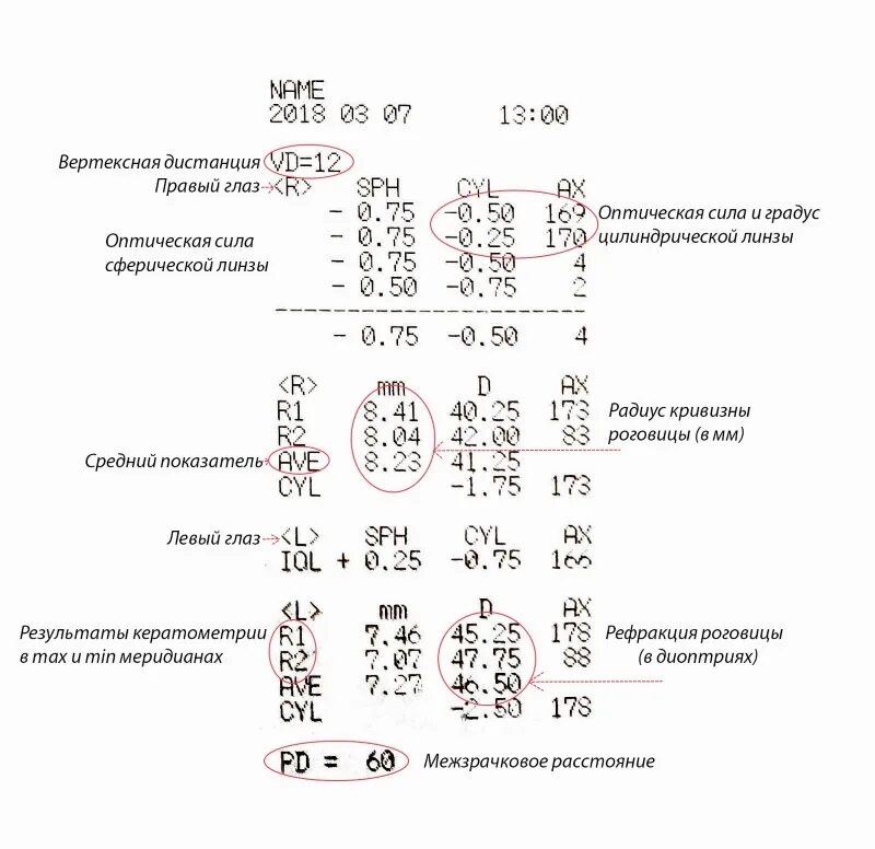 Рецепт на очки образец. Visus od sph. Sph -2. Sph cyl расшифровка зрения. Рецепт на очки.