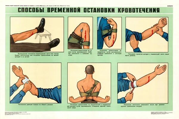 Временная остановка кровотечения алгоритм. Временная остановка кровотечения способы. Временные меры остановки кровотечения. Методы временной остановки кровотечения. Временный способ остановки кровотечения.