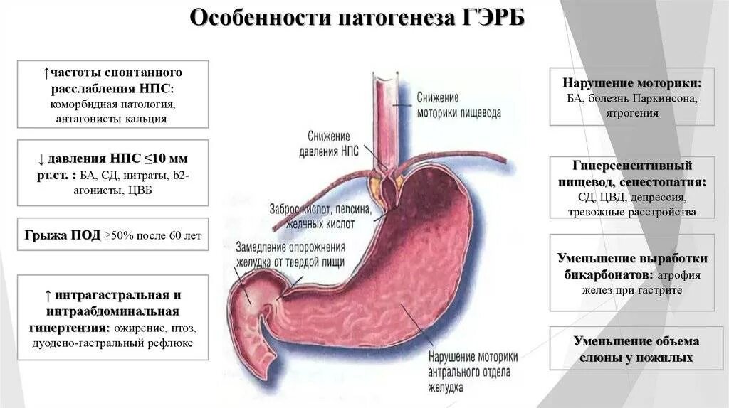 Антральный рефлюкс. Патологические механизмы желудочно-пищеводного рефлюкса. Желудочно-пищеводный рефлюкс этиология. Гастроэзофагеальный рефлюкс этиология. Дуодено-гастрального рефлюкса.