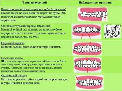 Вперед верхняя