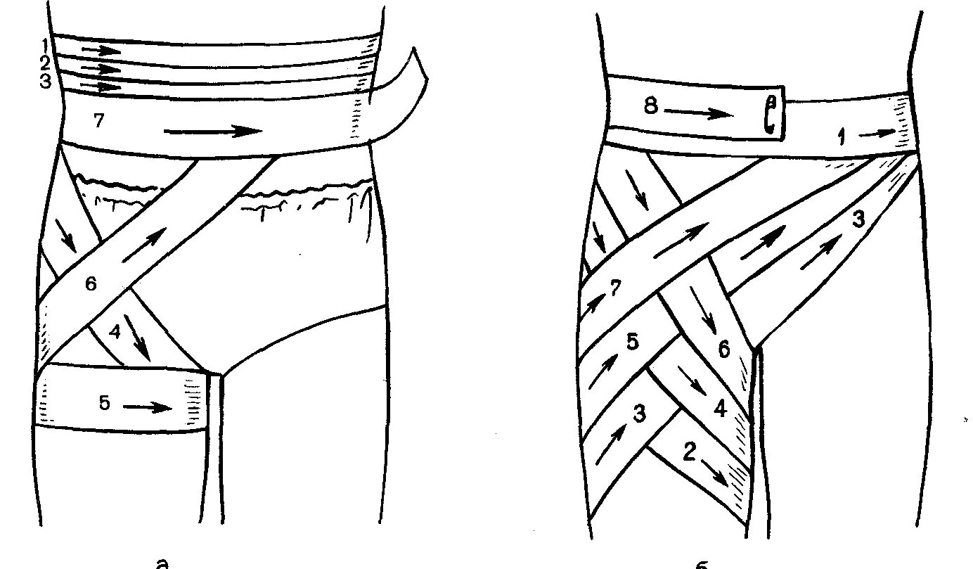 Техника наложения эластичного. Колосовидная повязка на нижнюю область живота. Колосовидная повязка на паховую область. Колосовидная повязка на тазобедренный сустав. Колосовидная повязка на бедро.