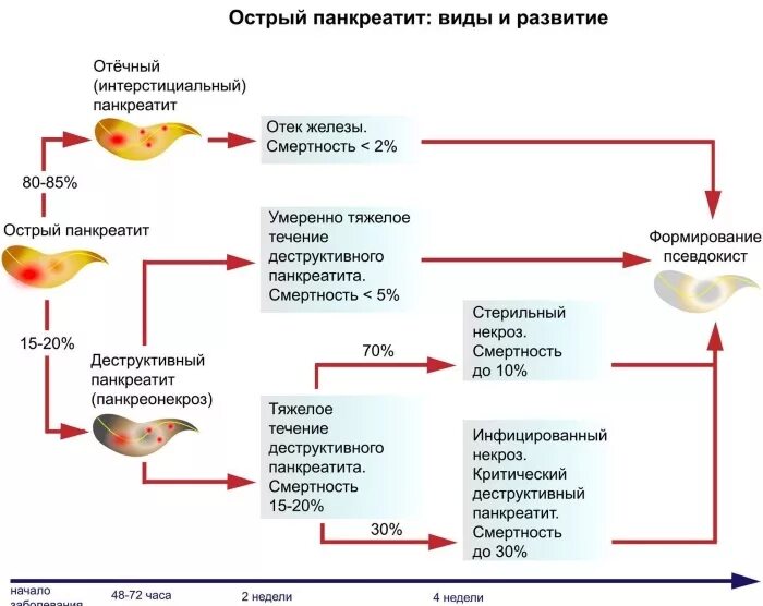 Панкреатит следующая стадия. Схема схема лечения хронического панкреатита. стадии развития болезни хронического панкреатита. типы острого панкреатита. клинические симптомы острого панкреатита.