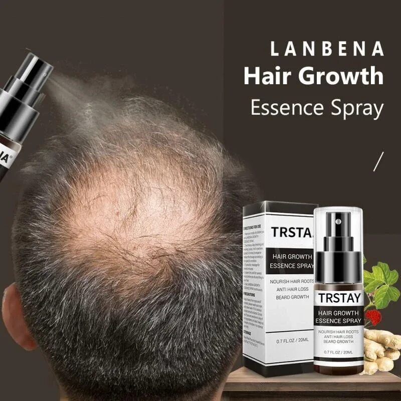 LANBENA hair growth Essence. LANBENA hair growth Spray спрей LANBENA против выпадения волос для роста волос. Спрей для волос от лысины. Спрей от облысения для мужчин.