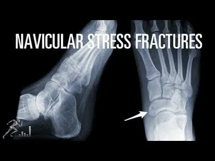 трусики жоқ қыздар