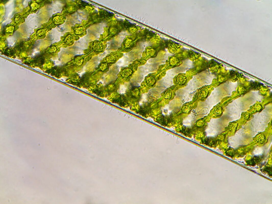 Спирогиру относят к. Нитчатая водоросль спирогира. Спирогира зеленая нитчатая водоросль. Водоросли улотрикс и спирогира. Спирофирапод микроскопом.