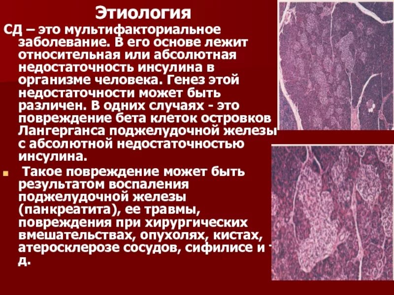 Какое заболевание при недостатке инсулина. СД этиология заболевания. Абсолютная недостаточность инсулина. Этиология мультифакториальной патологии.