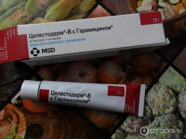 Разогревающие мази при остеохондрозе грудного отдела. Мазь обезболивающая фастум гель. Мазь для растирания мышц шеи. Маз для остреохондроза. Какой мазью лечить шею.