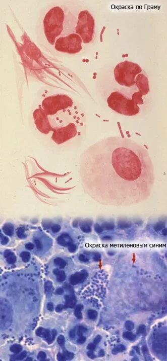 Гонорея микроскопия мазка. Гонококк микроскопия мазка. Трихомонады окрашенные метиленовым синим. Хламидии Романовскому Гимзе. Гонококки хламидии