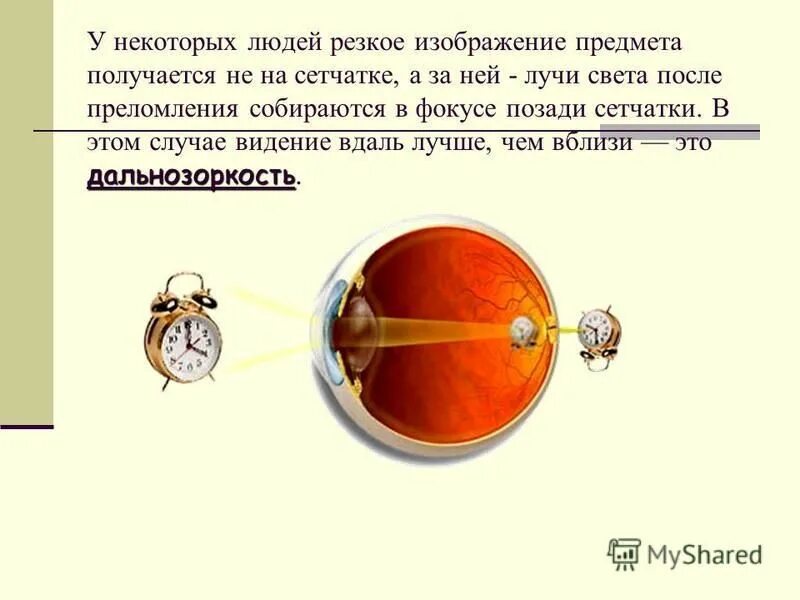Как мы видим предметы физика. Механизмы аккомодации глаза. Измерение мощности. В каком случае виден предмет. В каком случае виден предмет.