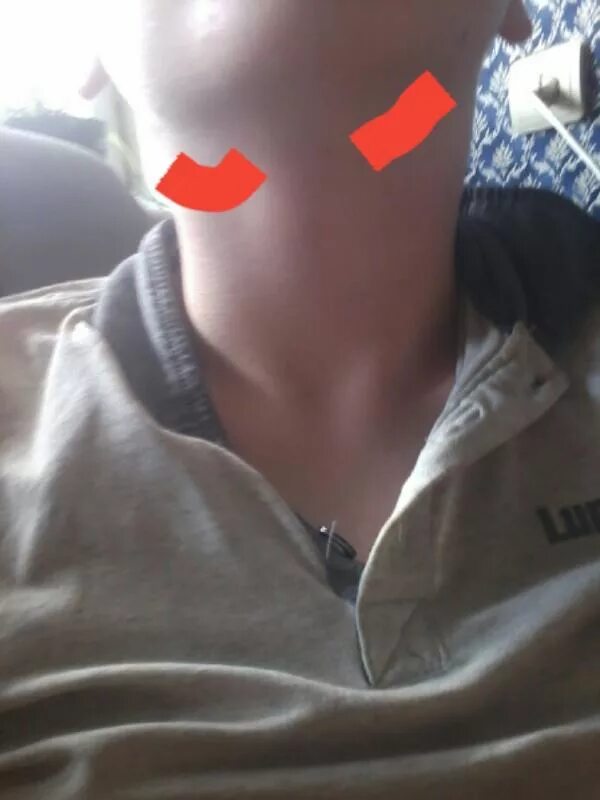 Почему болит кадык. Кадык кость. Щетовидная железа у му. Мужская шея. Почему болит кадык.