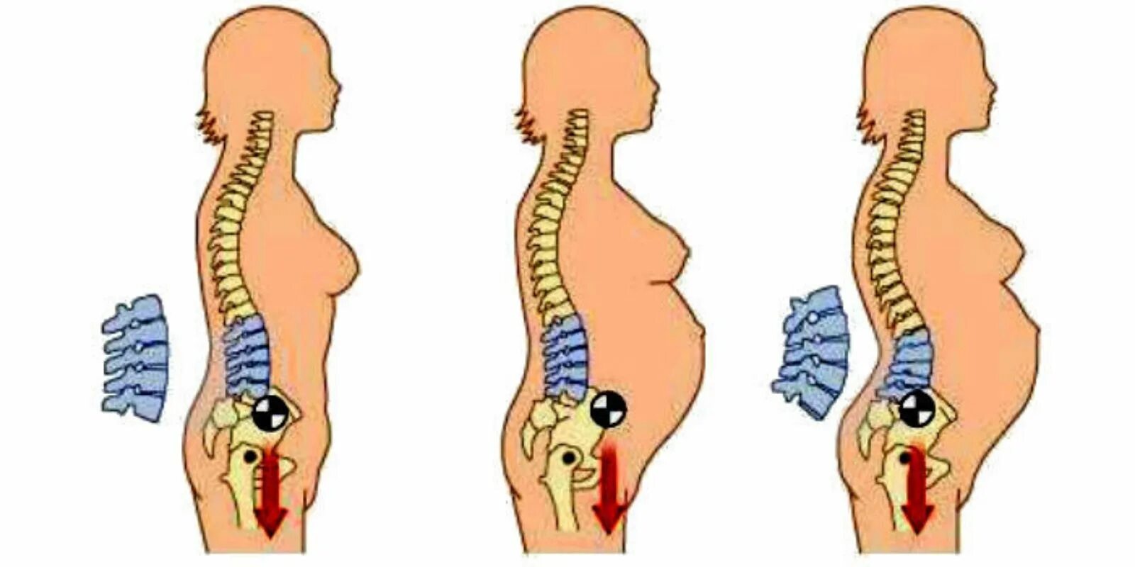 Боли пояснице третьем триместре беременности. Боль в копчике при беременности. Болит позвоночник при беременности. Осевая нагрузка на позвоночник.