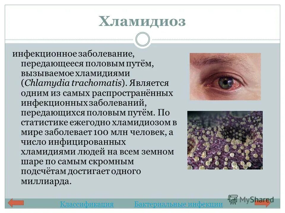 Имена заболевших. Хламидийные заболевания глаз. Хламидиоз клинические проявления. Кожные инфекции заболевания. Проявление заболеваний на глазах.