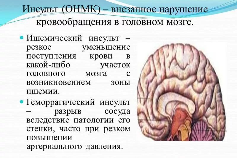 Нарушение кровообращения мозга. Нарушения мозгового кровоснабжения. Ишемические нарушения мозгового кровообращения. Ишемические нарушения головного мозга. Постишемические изменения мозга