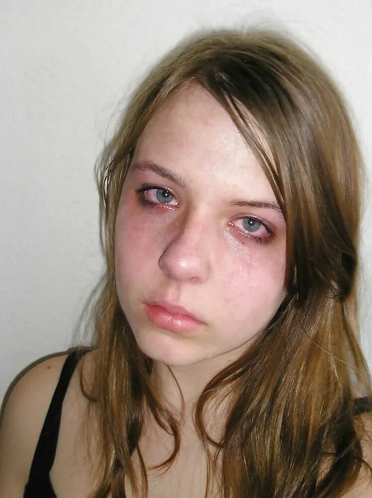 Некрасивый прыщавый. Страшная женщина в очках. Некрасивое лицо девушки. Красивая двушка с прыщами. Некрасивое лицо девушки.