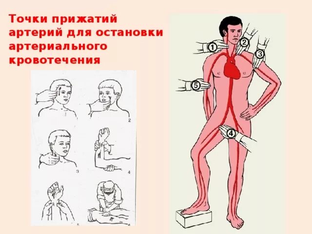 Точки прижатия артерий для остановки кровотечения. Точки прижатия артерий для остановки кровотечения из сосудов. Точки прижатия важнейших артерий. Места прижатия артерий на теле человека при кровотечениях.