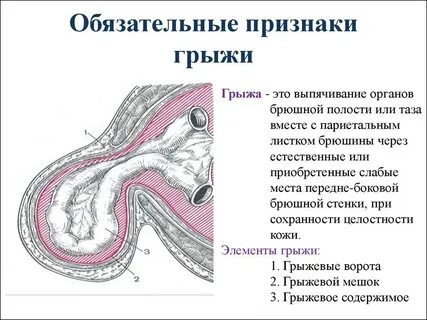 Какие есть грыжи