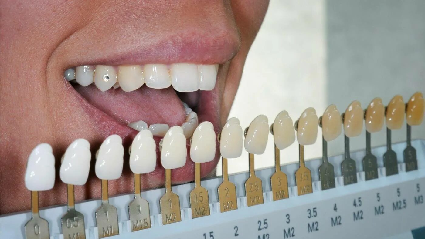 Палитра стоматология