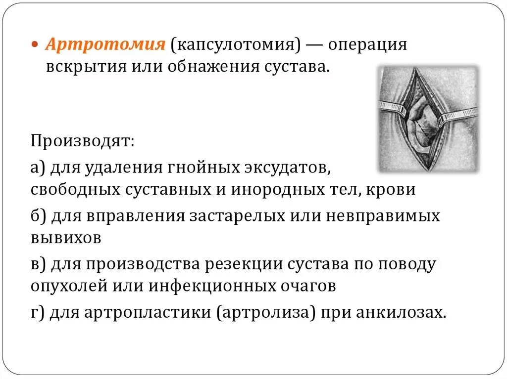 Артротомия плечевого сустава. Артротомия по Лангенбеку. Артротомия плечевого сустава схема. Артротомия локтевого сустава по Лангенбеку. Задняя артротомия плечевого сустава.