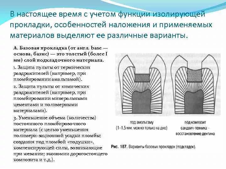 Изолирующая функция. Варианты наложения изолирующей прокладки 1 класс. Методика наложения изолирующей прокладки стоматология. Изолирующие прокладки, цель применения. Базовые прокладки и лайнеры.. Варианты наложения изолирующих прокладок.