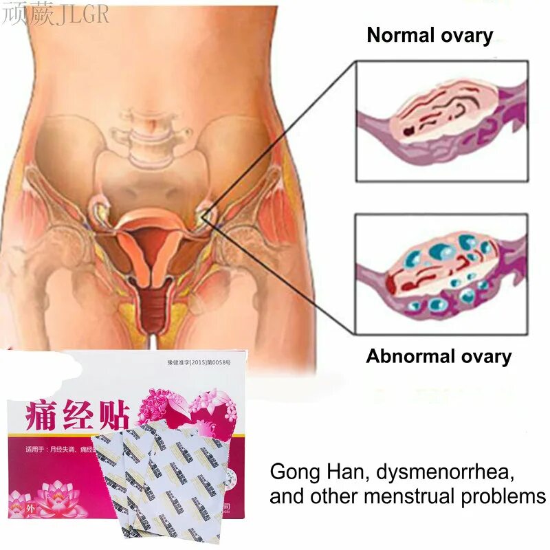 как расположены яичники у женщин