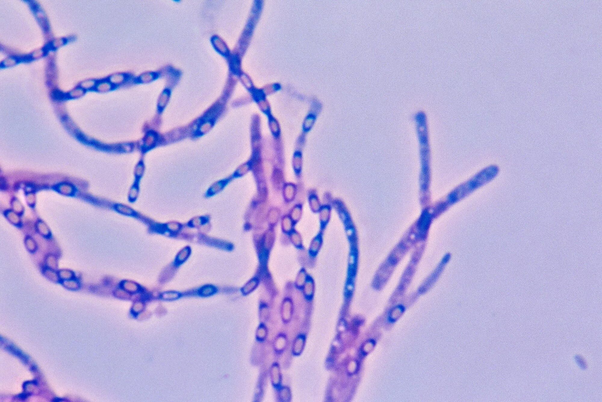 Бацилла антрацис Сибирская язва. Bacillus anthracis. Bacillus anthracis, а22 (Сибирская язва).