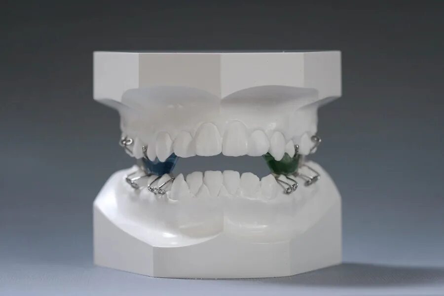 ппарат твин-блок ларка. Аппарат твин блок кларка. Двухчелюстной аппарат twin block. Аппарат твин блок ортодонтия. Twin block.