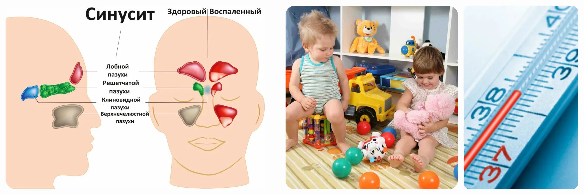 Можно ли дышать картошкой при насморке. Как дышать картошкой при кашле детям. как правильно дышать над картошкой при кашле и насморке ребенку. дышим картошкой при насморке дышим. как правильно дышать над картошкой при кашле и насморке взрослому.